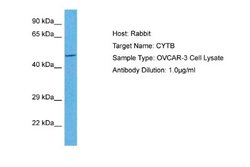 CYTB Rabbit anti-Human, Polyclonal, Novus Biologicals 0.1 mL | Buy Online | Novus Biologicals | Fisher Scientific